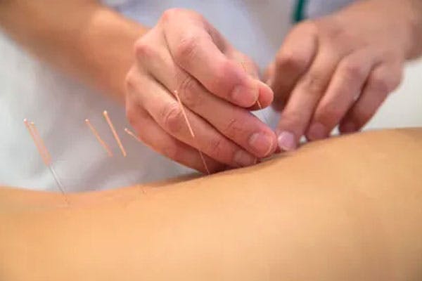 Glasgow Physiotherapy and Performance Centre